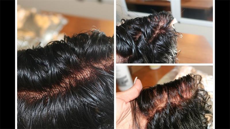 Bleach Knots On Lace Closure: Should Or Should Not - Anka Hair